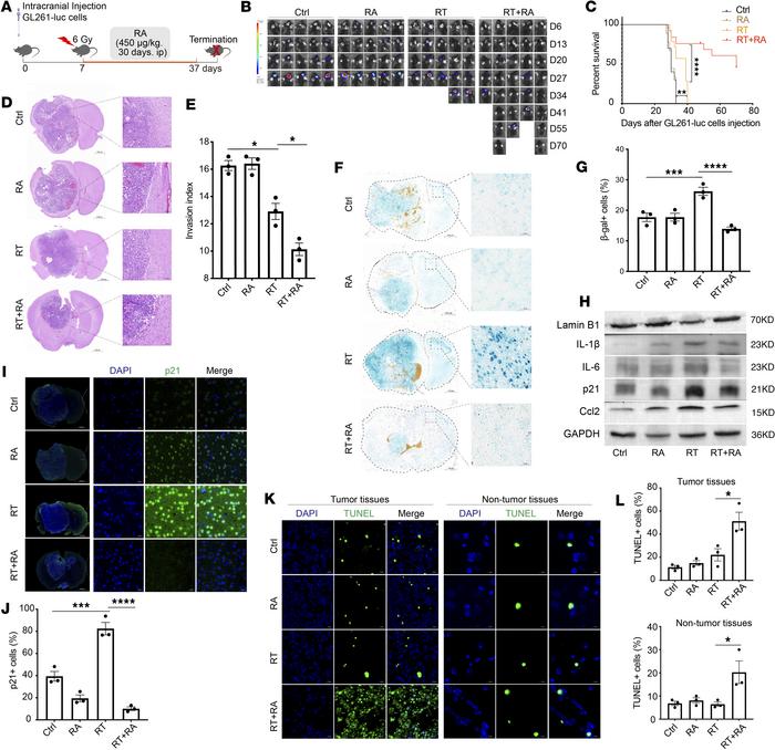 RA reduces senescent cells and extends the survival of GBM mice.
(A) Sch...
