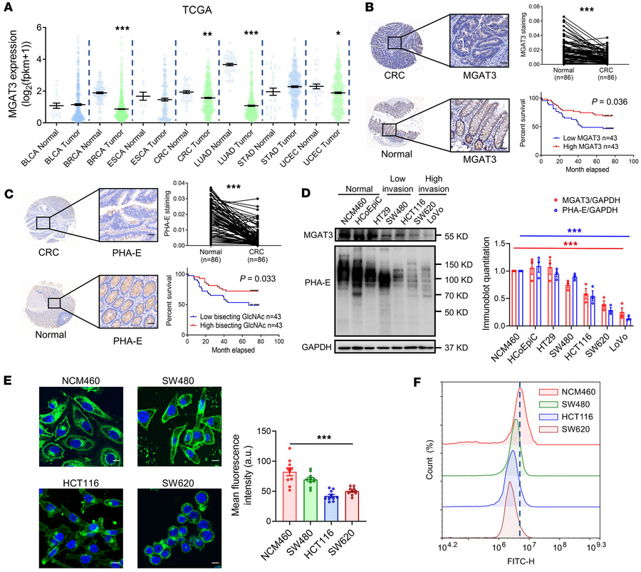 Bisecting GlcNAc levels are reduced in CRC tissues.
(A) MGAT3 expression...