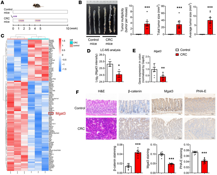 Bisecting GlcNAc levels are reduced in the colonic tissue of CRC mice.
(...