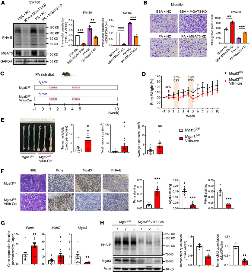 PA inhibits CRC carcinogenesis through the regulation of bisecting GlcNA...