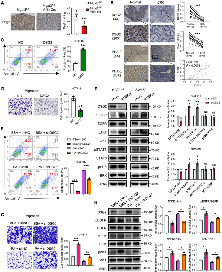 PA inhibits CRC carcinogenesis through bisecting GlcNAc–modified DSG2.
(...