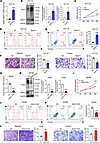 Bisecting GlcNAc inhibits tumorigenesis of CRC cells.