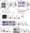 PA inhibits CRC carcinogenesis through the regulation of bisecting GlcNAc.