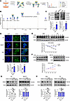 PA stabilizes DSG2 expression through bisecting GlcNAc.