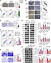PA inhibits CRC carcinogenesis through bisecting GlcNAc–modified DSG2.