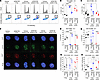 AZD6738 promotes G2-M transition after irradiation and increases residual D