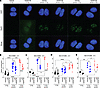 AZD6738 (1 μM) significantly reduces RAD51 foci formation in NCI-H460 cells