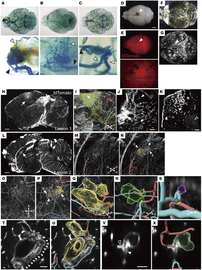 Three-dimensional analyses reveal a nidus structure in cleared brains of...