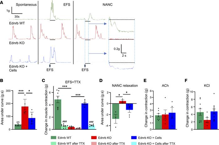 EFS demonstrates functional recovery of smooth muscle contractility in E...