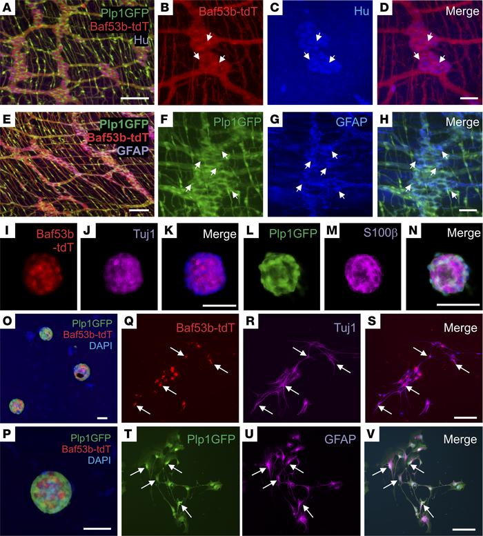 Isolation, expansion, and differentiation of ENSCs from Plp1GFP;Baf53b-t...