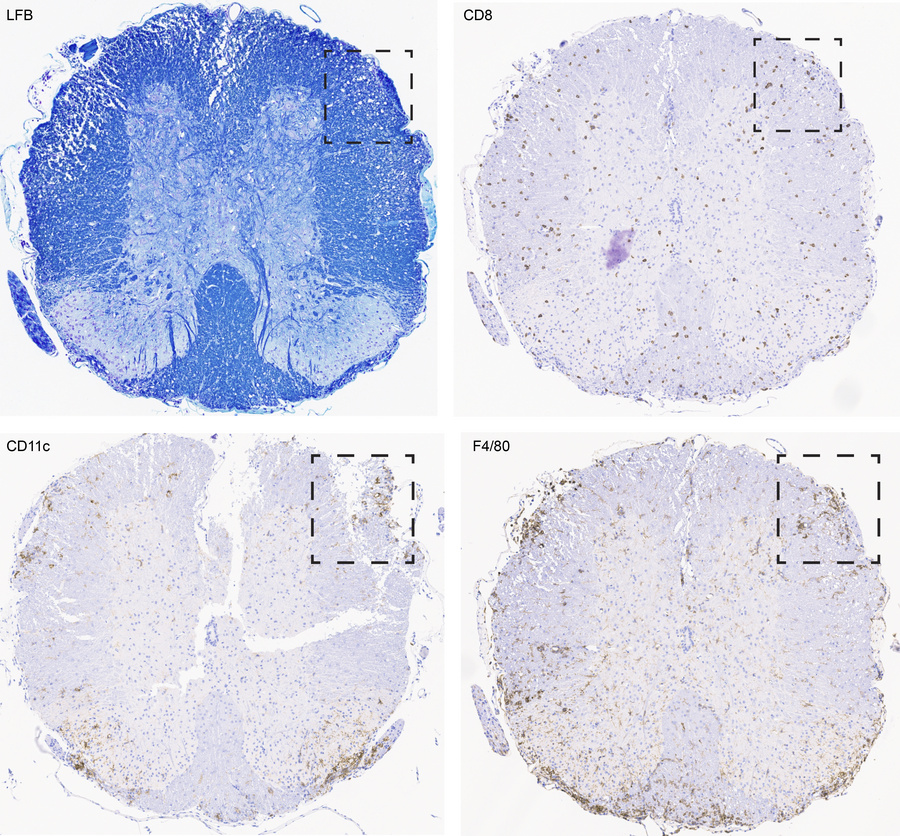 CD8 T cells infiltrate into the white and gray matter of the spinal cord...