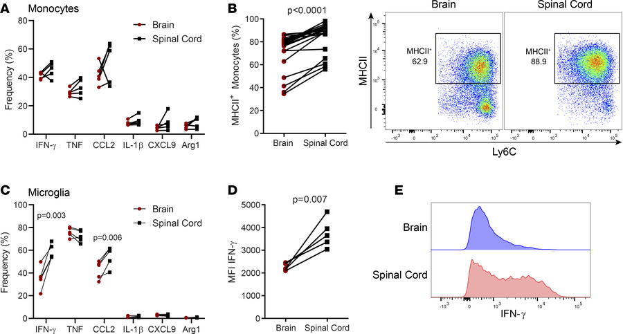 Myeloid cells exhibit distinct inflammatory profiles in the brains and s...