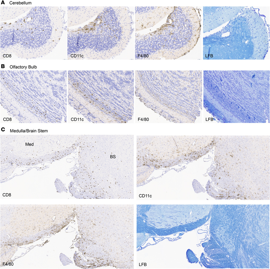 CD8 T cell infiltration in CD8-EAE is concomitant with regional innate i...