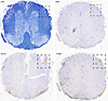 CD8 T cells infiltrate into the white and gray matter of the spinal cord du
