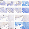 CD8 T cell infiltration in CD8-EAE is concomitant with regional innate immu