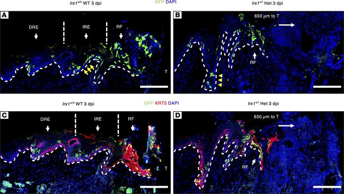 Delayed KC proliferation and migration in Irx1+/– mice at 3 dpi.
(A) Rep...
