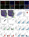 Hypoxia is associated with local complement signaling in GBM tumors.