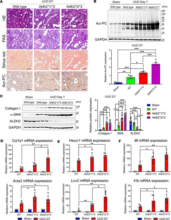 Evaluation of Acr-PCs, fibrosis markers, inflammatory cytokines, and kid...