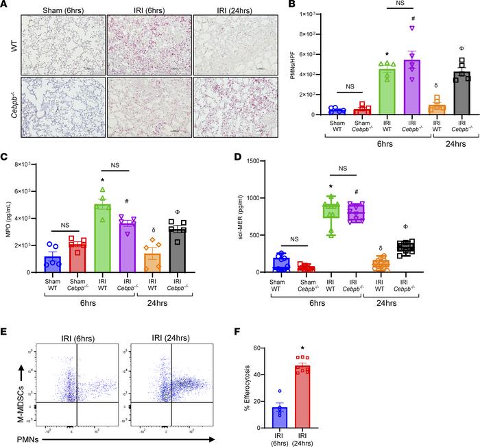 
Cebpb–/– mice experienced sustained neutrophil infiltration and activat...