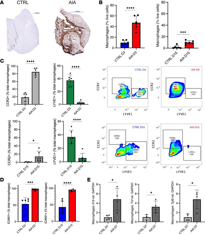 Chronic macrophage infiltration contributes to a dysregulated cytokine m...