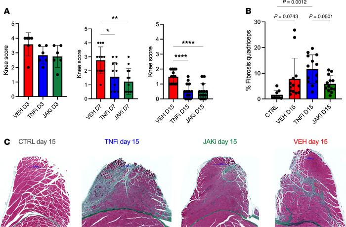 TNF inhibition ameliorates joint pathology but exacerbates periarticular...