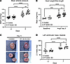 Proximal tubule ACE2 attenuates early hypertension and cardiac hypertrophy.