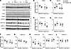 Alterations in sodium transporters along the proximal tubule and medullary