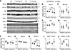Alterations in sodium transporters along the more distal segments of the ne