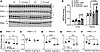 Inappropriate regulation of ENaCγ and Na,K-ATPase activity impairs pressure