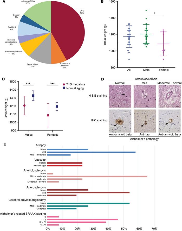Gross and histopathological exams of 26 brains from T1D Medalists.
(A) C...