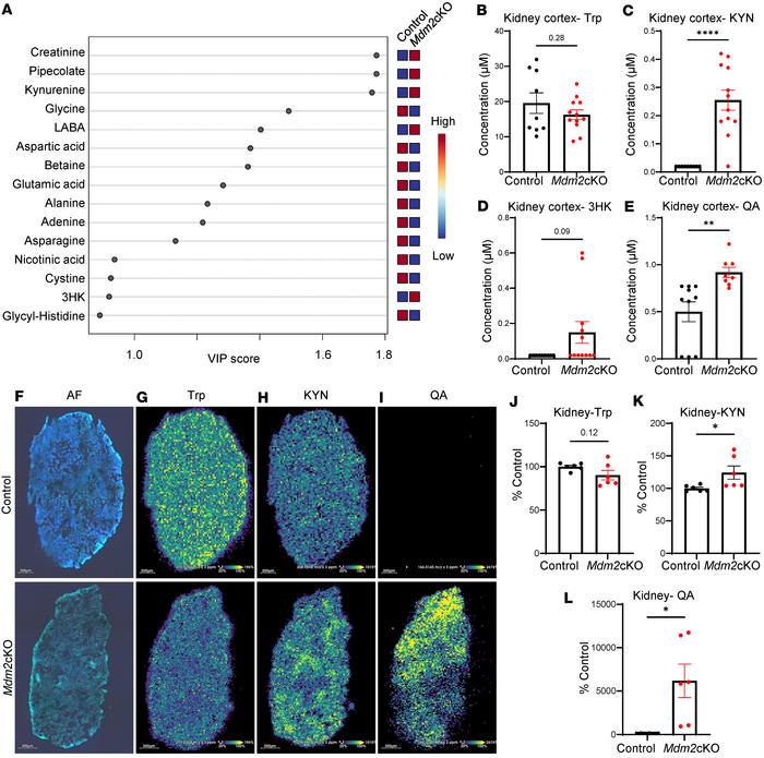 Trp metabolism is altered in the kidney during renal failure.
Targeted m...