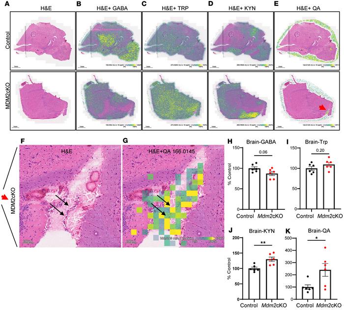 Increased brain KYN and QA levels in mice with rapid kidney failure.
MAL...