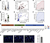 The correlation between mucosal HAS2 and MMP3 expression in patients with I
