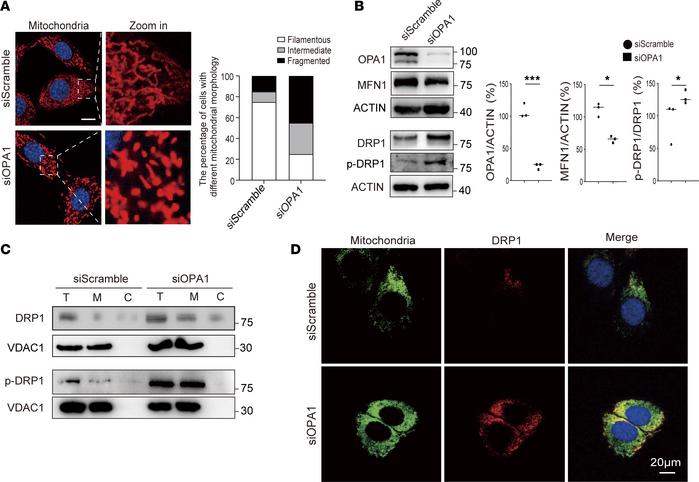 OPA1 knockdown enhanced DRP1 expression and disrupted mitochondrial morp...