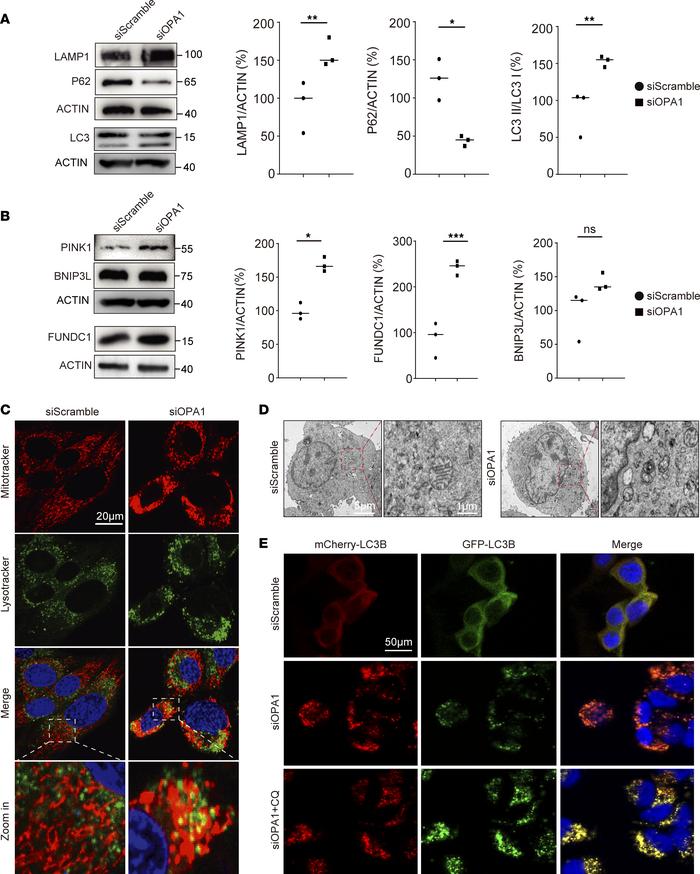 OPA1 participates in molecular interplay with DRP1, and Mdivi-1 mitigate...