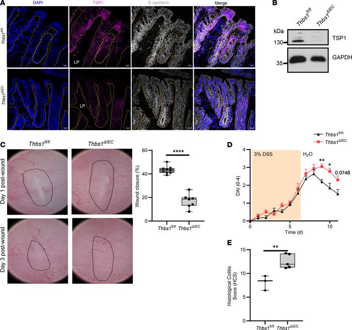 Epithelium-derived TSP1 is critical for in vivo mucosal wound repair.
(A...