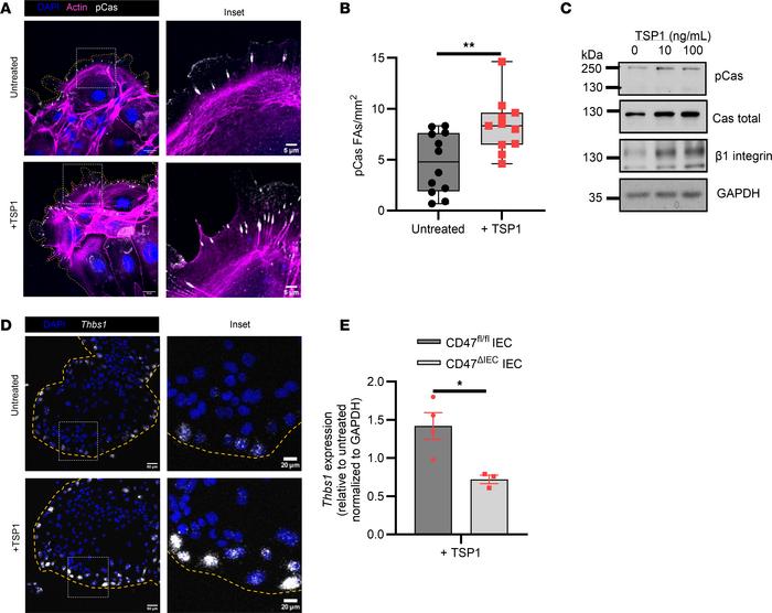 TSP1 enhances IEC migration with enhanced focal adhesion formations at t...
