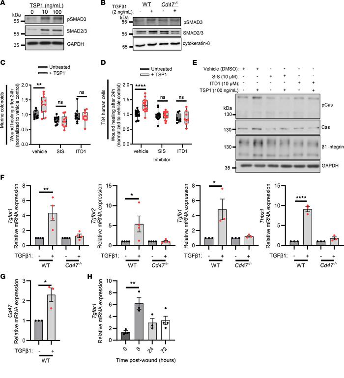 IEC migration in response to TSP1 is TGF-β1 dependent.
(A) Western blot ...