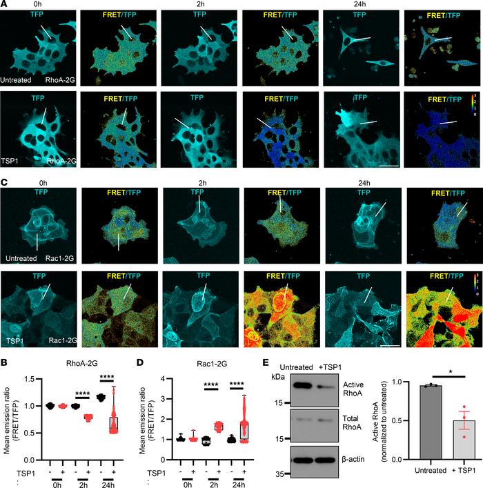TSP1 promotes Rac1 and inhibits RhoA activity.
(A) Immunofluorescence of...