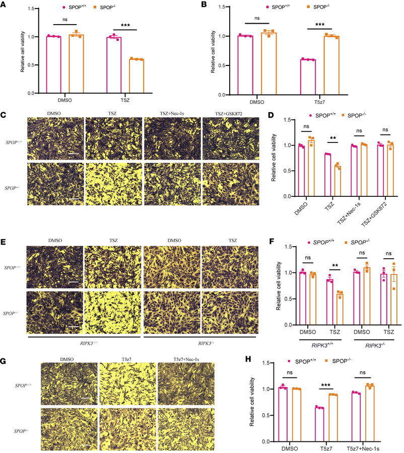 SPOP deficiency protects against apoptosis and mediates necroptosis.
(A)...