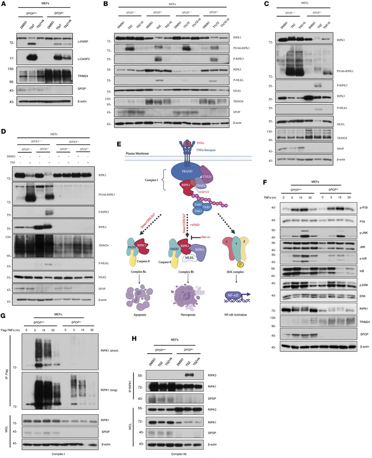 SPOP deficiency breaks the balance between RIPK1 and RIPK3 and facilitat...