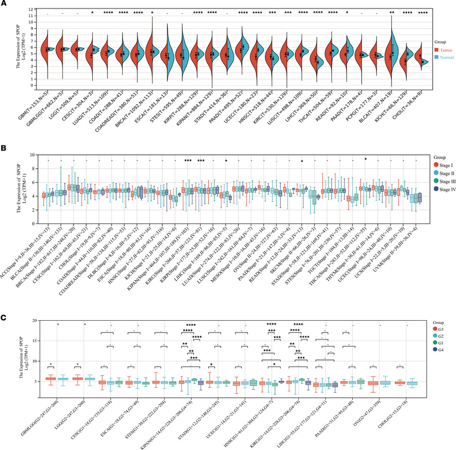 Pancancer analysis of SPOP.
(A) Pancancer analysis of SPOP expression in...