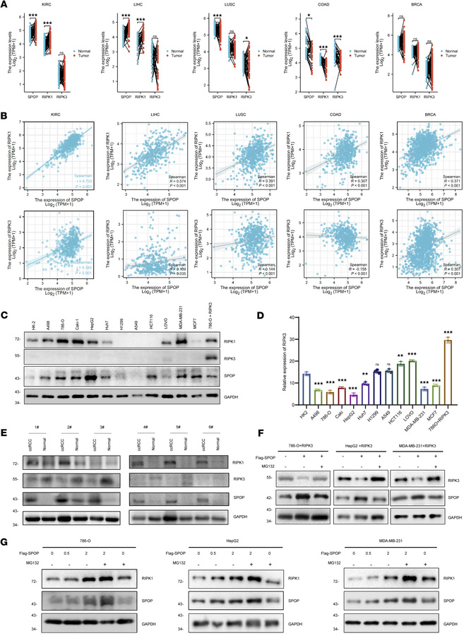 SPOP correlates with RIPK1 rather than RIPK3 in tumors.
(A) The mRNA exp...