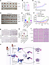 SM164 enhances antitumor activity of sunitinib on xenograft models.