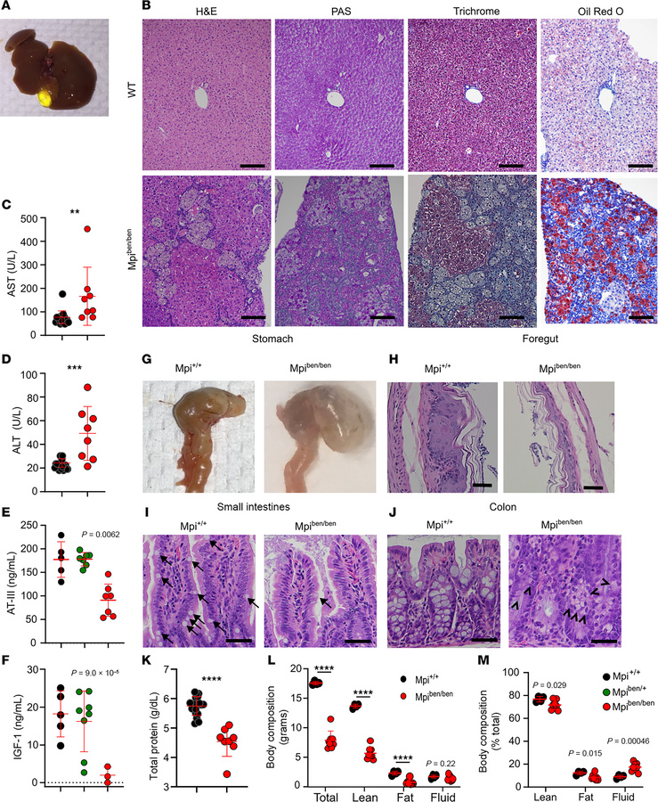 Liver and gastrointestinal tract are histologically and biochemically ab...