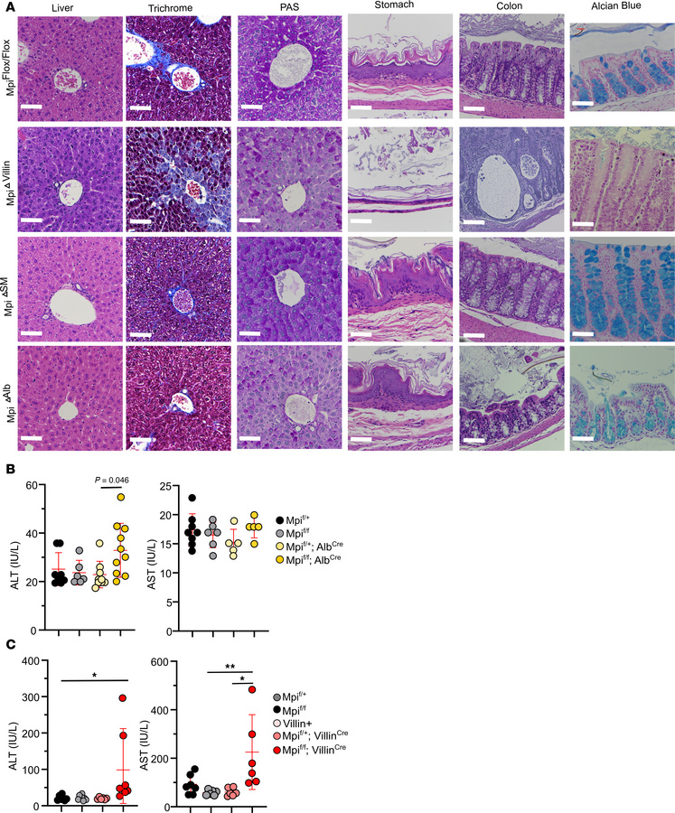 Histopathology of stomach and colon linked to intestinal Mpi deficiency....