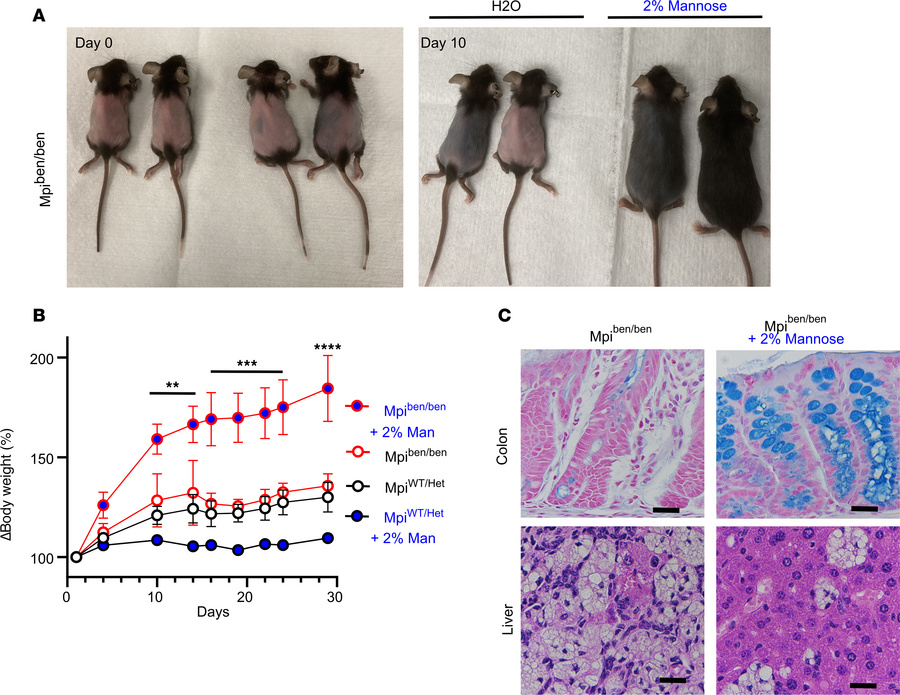 Oral mannose therapy rescues Mpi deficiency.
(A) Mpiben/ben mice were tr...
