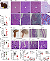 Liver and gastrointestinal tract are histologically and biochemically abnor