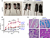 Oral mannose therapy rescues Mpi deficiency.