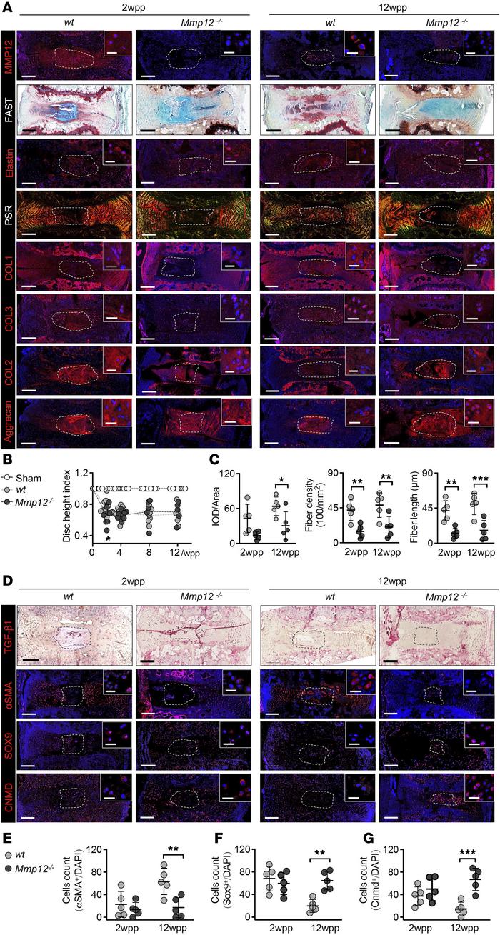 Inhibition of NP fibrosis and myofibroblast formation in Mmp12–/– mice.
...